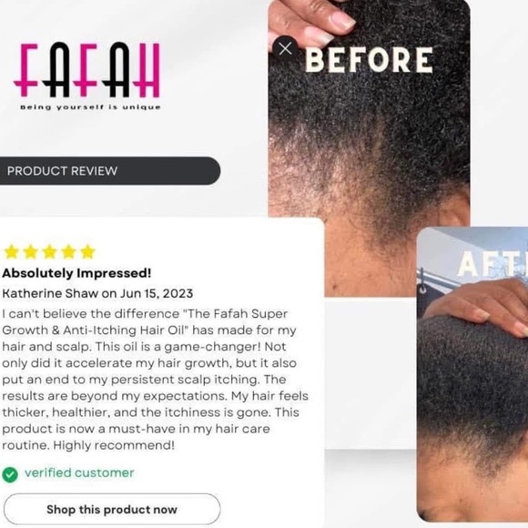 Magic Fix Hair Growth Oil - Picture 5 of 13